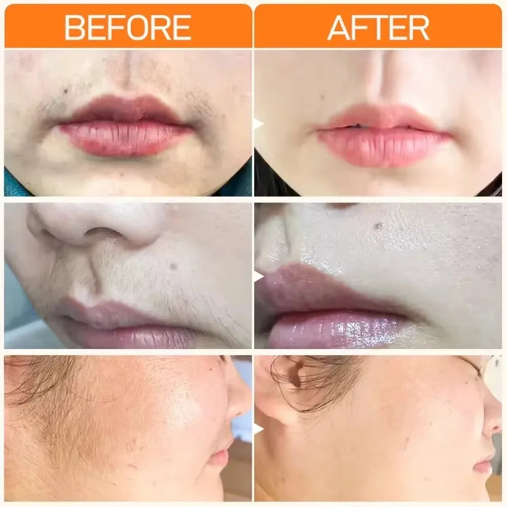 DEPILAÇÃO EXPRESS 3 MIN- CREME INDOLOR & INIBIDOR DE PELOS