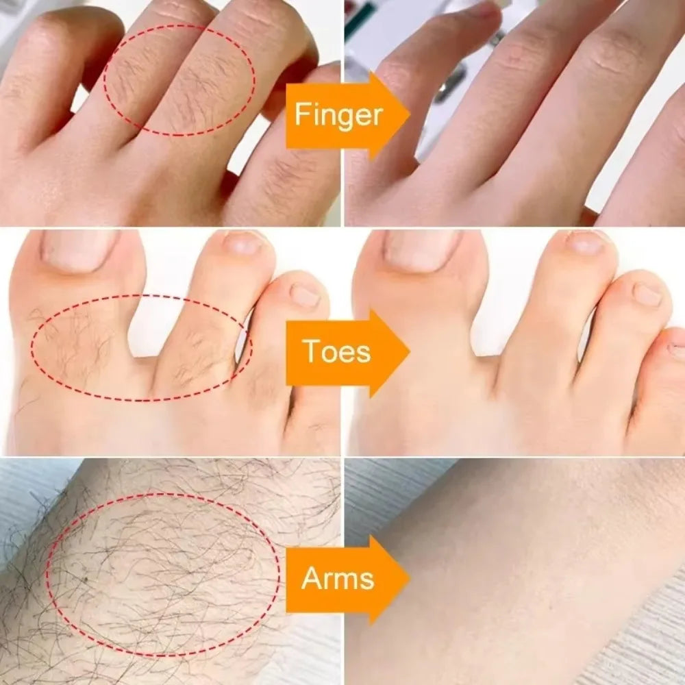 DEPILAÇÃO EXPRESS 3 MIN- CREME INDOLOR & INIBIDOR DE PELOS