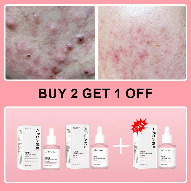 SERUM COREANO PDRN DE SALMÃO- RENOVADOR E FIRMADOR